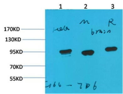 HSP90 α Monoclonal antibody(7D6)