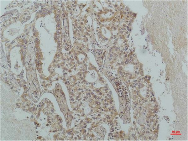 IκB β Monoclonal Antibody(1F3)