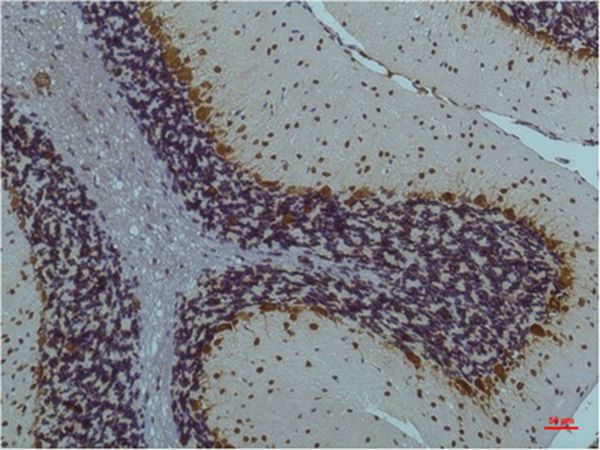 CaMKIIβ/γ/δ (Phospho Thr287) Monoclonal Antibody(1B9)