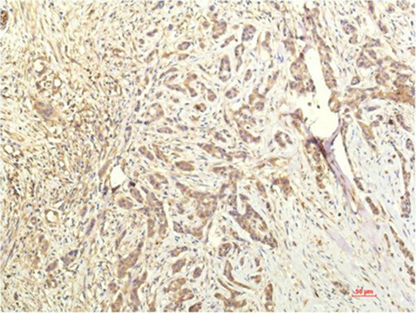 STAT1 Mouse Monoclonal Antibody(8H11)