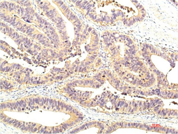 STAT1 Mouse Monoclonal Antibody(8H11)