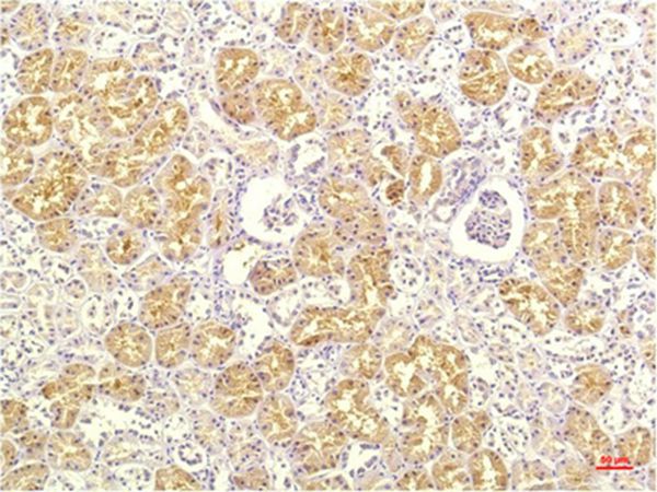 IL-8 Mouse Monoclonal Antibody(13F8)