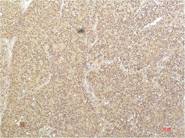 SGK1 Mouse Monoclonal Antibody(4D12)