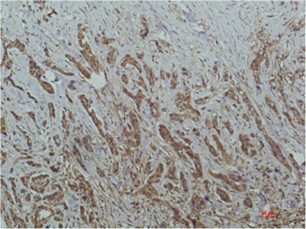 HDAC1 Mouse Monoclonal Antibody(4E1)