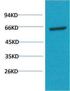 AKT Mouse Monoclonal Antibody(1H2)