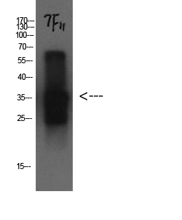 Cystatin C Mouse Monoclonal Antibody(7F11)