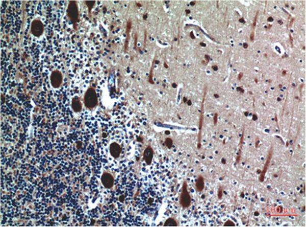 Cystatin C Mouse Monoclonal Antibody(5F1)