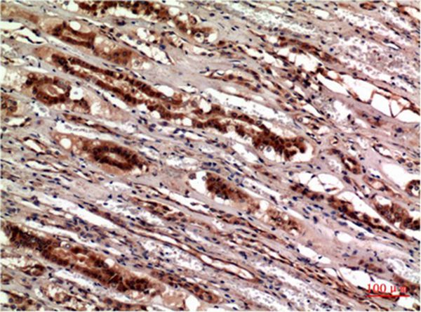 Cystatin C Mouse Monoclonal Antibody(5F1)