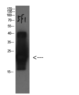 Cystatin C Mouse Monoclonal Antibody(5F1)