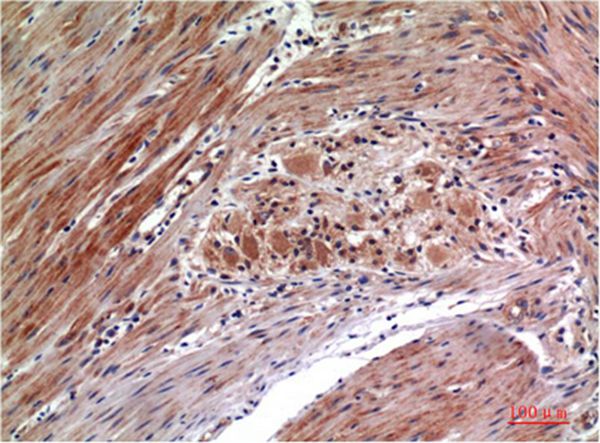 Phospho-ERK 1/2 (Y222/205)Mouse Monoclonal Antibody(4G3)