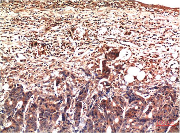 Ubiquitin Mouse Monoclonal Antibody(5F1)