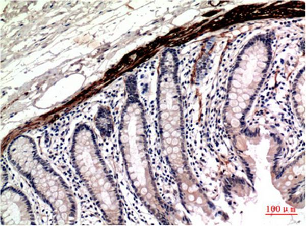 Muscle actin Mouse Monoclonal Antibody(2H3)