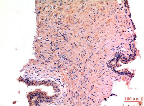 LC3A Mouse Monoclonal Antibody(5G10)