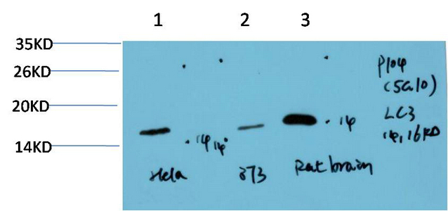 LC3A Mouse Monoclonal Antibody(5G10)