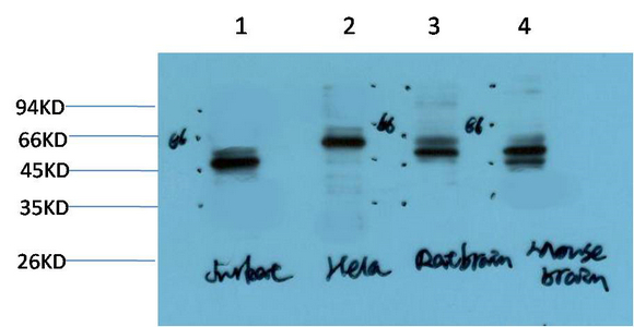 Gamma Tubulin Mouse Monoclonal Antibody(7B1)