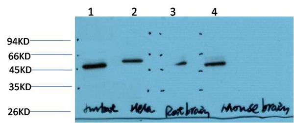 Gamma Tubulin Mouse Monoclonal Antibody(6C12)