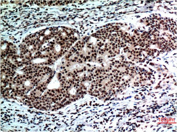 Beclin-1 Mouse Monoclonal Antibody(5C5)