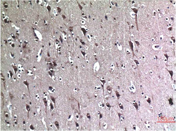 Beclin-1 Mouse Monoclonal Antibody(5C5)