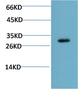 CHOP Mouse Monoclonal Antibody(2B1)