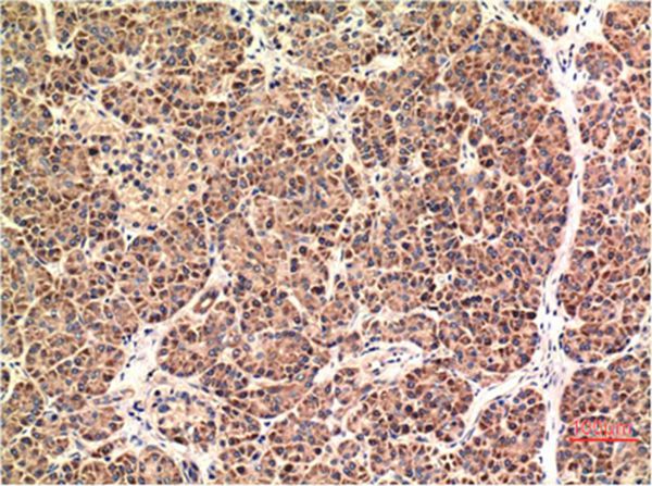 CHOP Mouse Monoclonal Antibody(1E1)