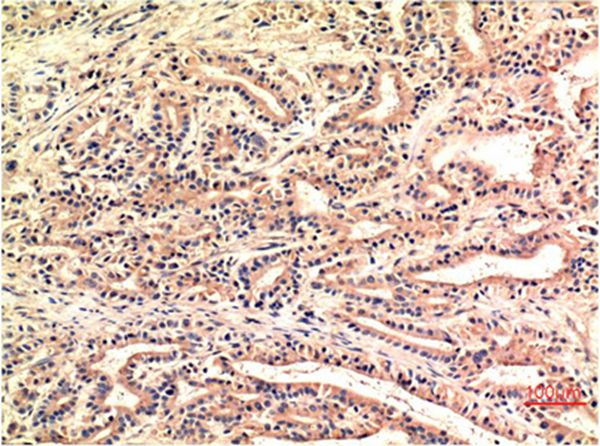 CHOP Mouse Monoclonal Antibody(1E1)