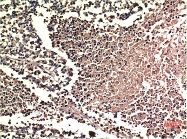 ERK1/2 Mouse Monoclonal Antibody(1H4)