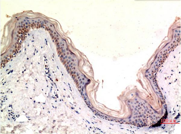 MLKL Mouse Monoclonal Antibody(8H7)