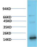 TTR Mouse Monoclonal Antibody(1D7)