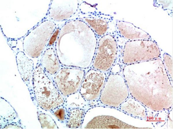 TTR Mouse Monoclonal Antibody(2B12)