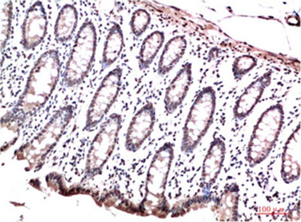 HP-1γ Mouse Monoclonal Antibody(2F5)