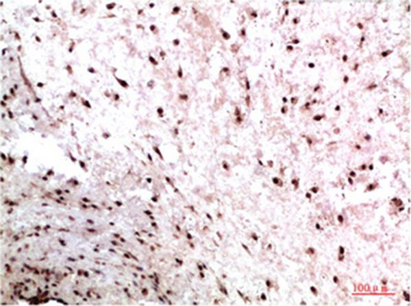 HP-1γ Mouse Monoclonal Antibody(2F5)