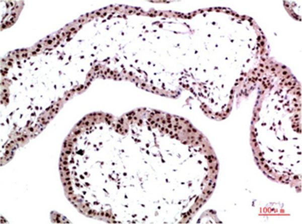 HP-1γ Mouse Monoclonal Antibody(3B9)