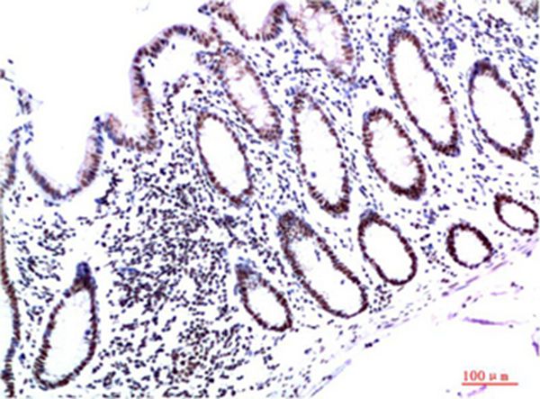 HP-1γ Mouse Monoclonal Antibody(3B9)