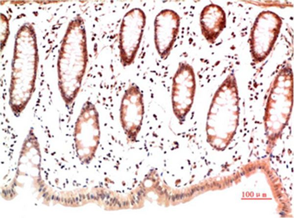 Collagen I Mouse Monoclonal Antibody(4H10)