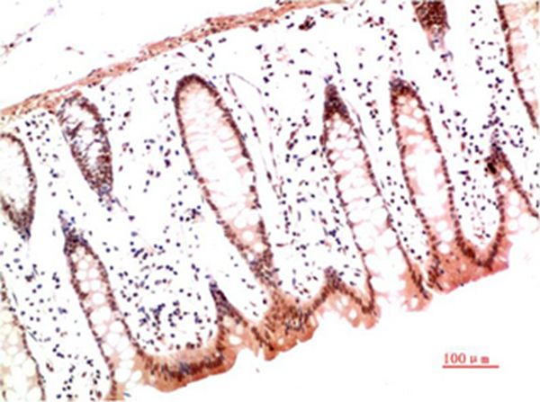 Collagen I Mouse Monoclonal Antibody(2D10)