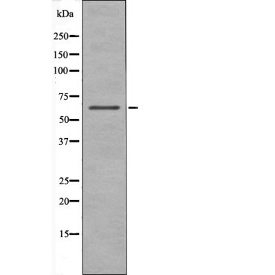 Chk2 (Phospho-Ser19) Antibody