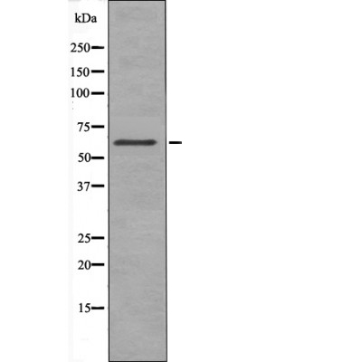 Chk2 (Phospho-Thr432) Antibody