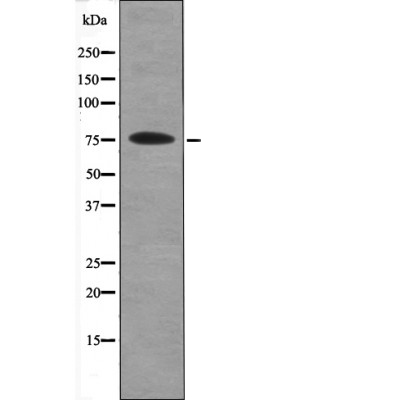 PKC β (Phospho-Ser660) Antibody