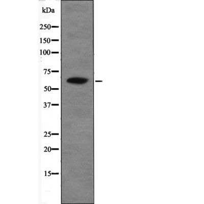 Chk2 (Phospho-Thr26+Ser28) Antibody