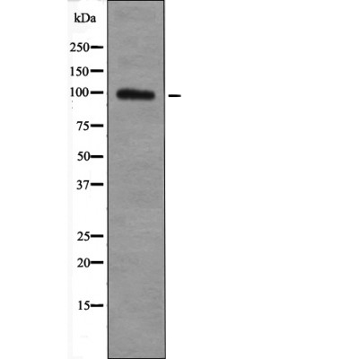 TGF β Receptor III (Phospho-Thr842) Antibody