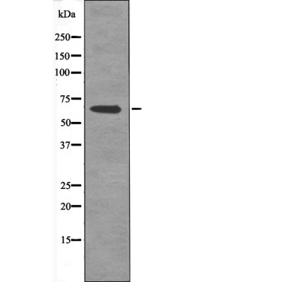 AFX1 (Phospho-Thr455) Antibody