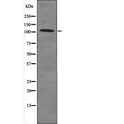 Retinoblastoma (Phospho-Thr252) Antibody