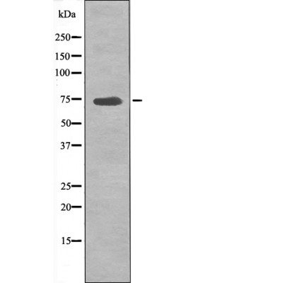 p70 S6 Kinase (Phospho-Ser427) Antibody