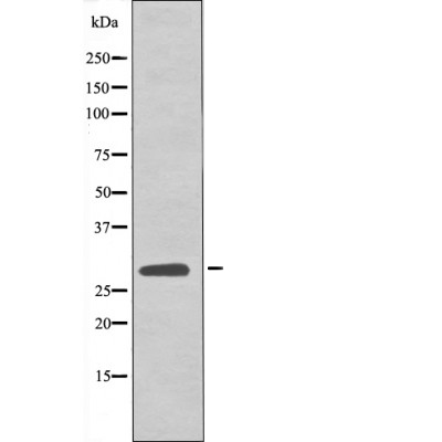 LAT (Phospho-Tyr161) Antibody