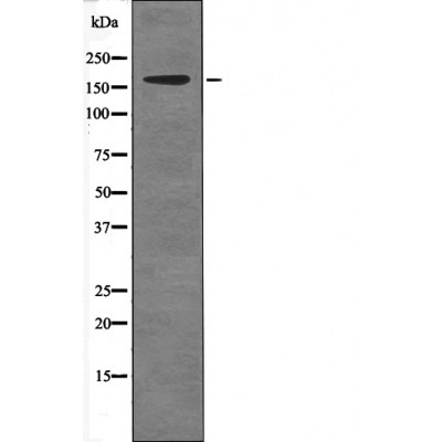 c-Ret (Phospho-Tyr981) Antibody