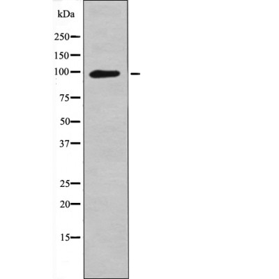 Leptin Receptor (Phospho-Tyr1141) Antibody