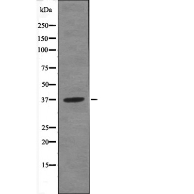 ANXA1 (Phospho-Tyr21) Antibody