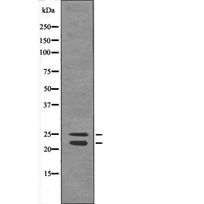 Bim (Phospho-Ser44/104) Antibody