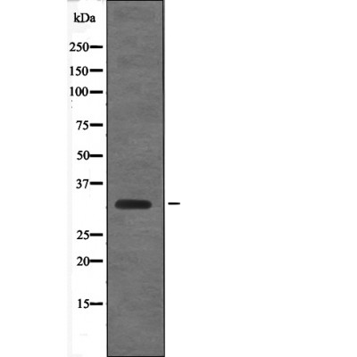 Cyclin D1 (Phospho-Thr288) Antibody