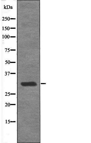 MBP (Phospho-Thr232) Antibody